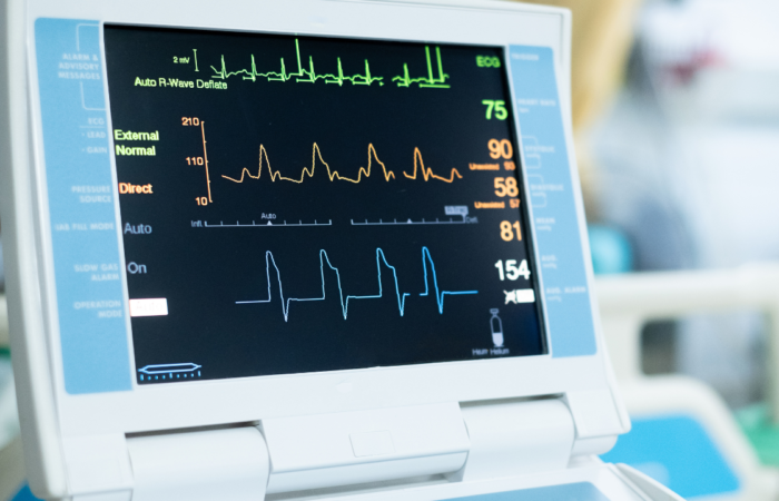 Continuous Oxygen Monitor: Essential Tool for Patient Safety