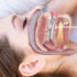 Sleep Apnea Appliance Dental: Effective Non-Invasive Treatment Option